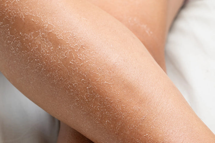 Raw Materials for Dry & Sensitive Skin | AOT